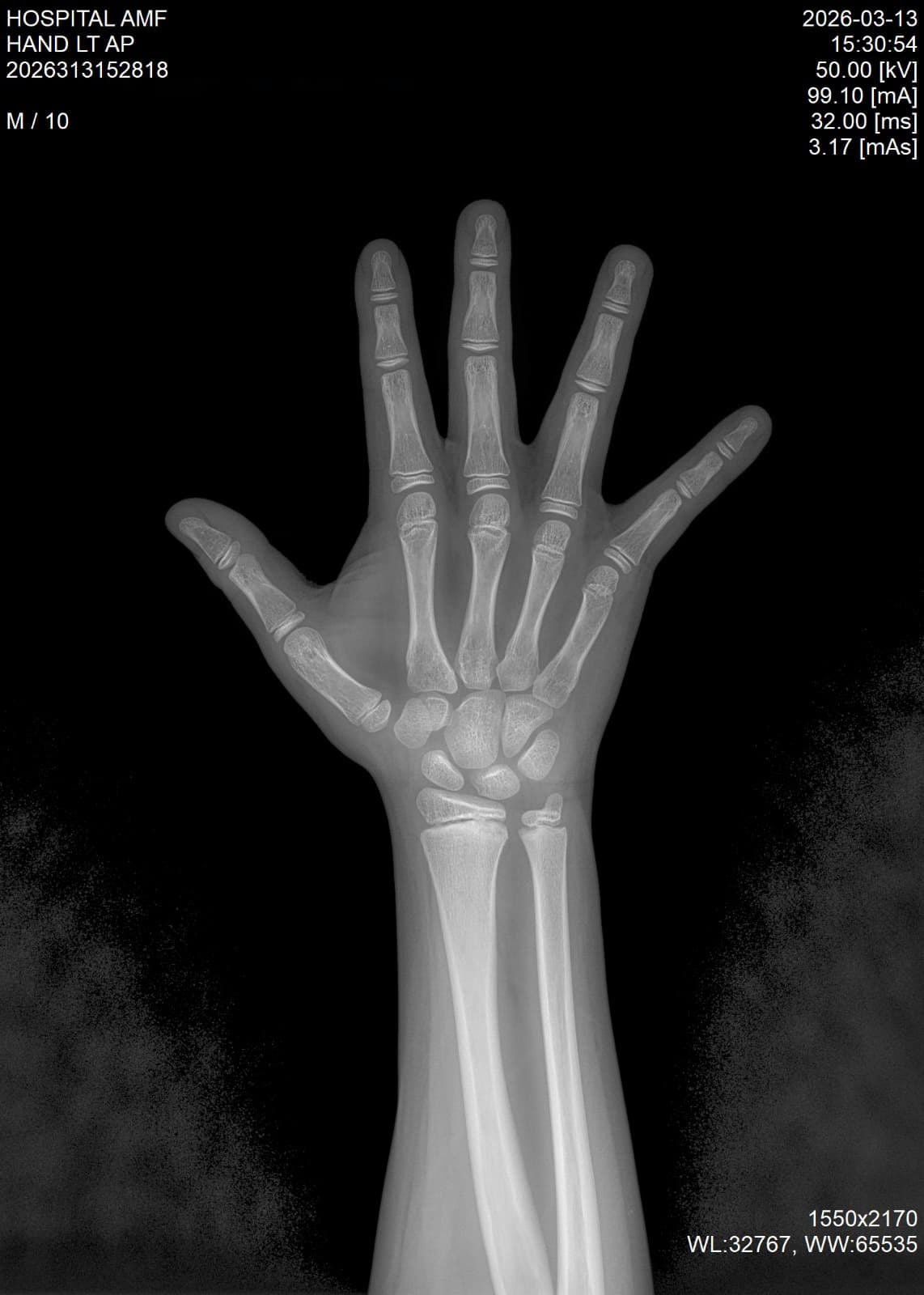 Radiología Digital